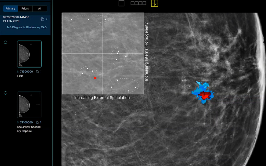 Xcellerant Ventures Leads DeepLook Medical’s Series A Round